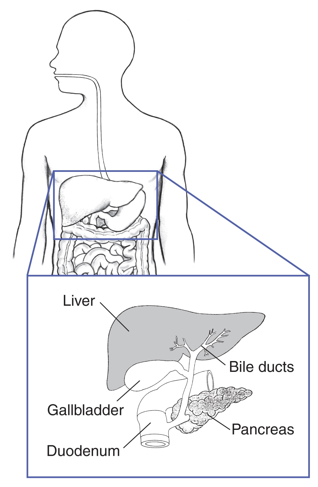 Human torso with an inset showing the liver, bile ducts, gallbladder, pancreas, and duodenum.