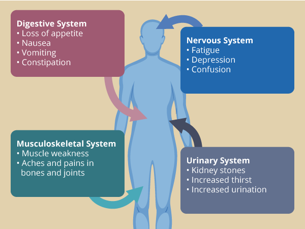human body with arrows indicating that primary hyperparathyroidism can affect the digestive system, nervous system, muscloskeletal system, and urinary system