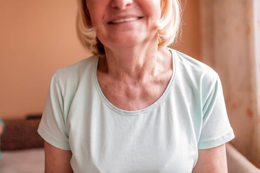 A smiling, senior woman with postoperative scar after thyroid surgery, close-up.