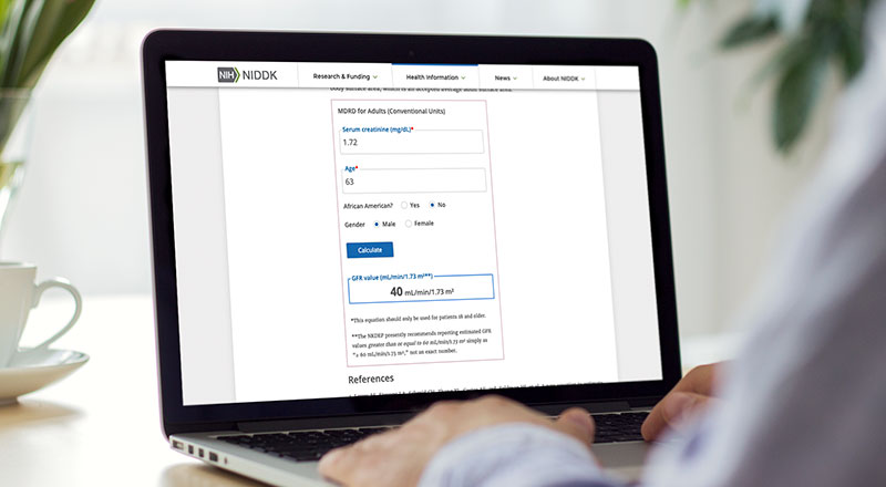 Photo of person using the Glomerular Filtration Rate calculator on a laptop