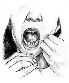 Drawing of a woman flossing her teeth.
