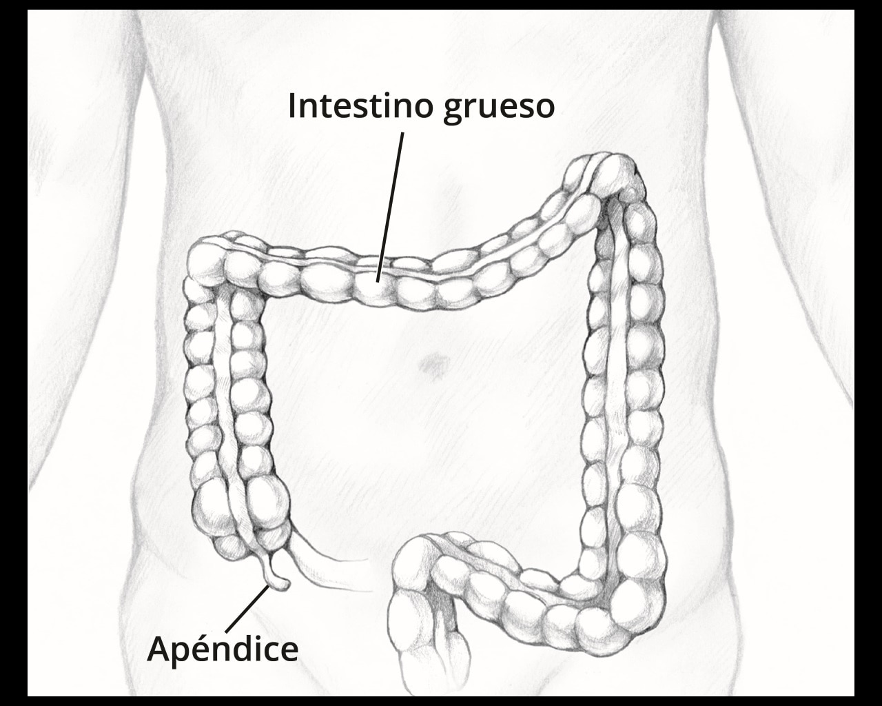 Ilustración del abdomen mostrando la posición del apéndice y del colon