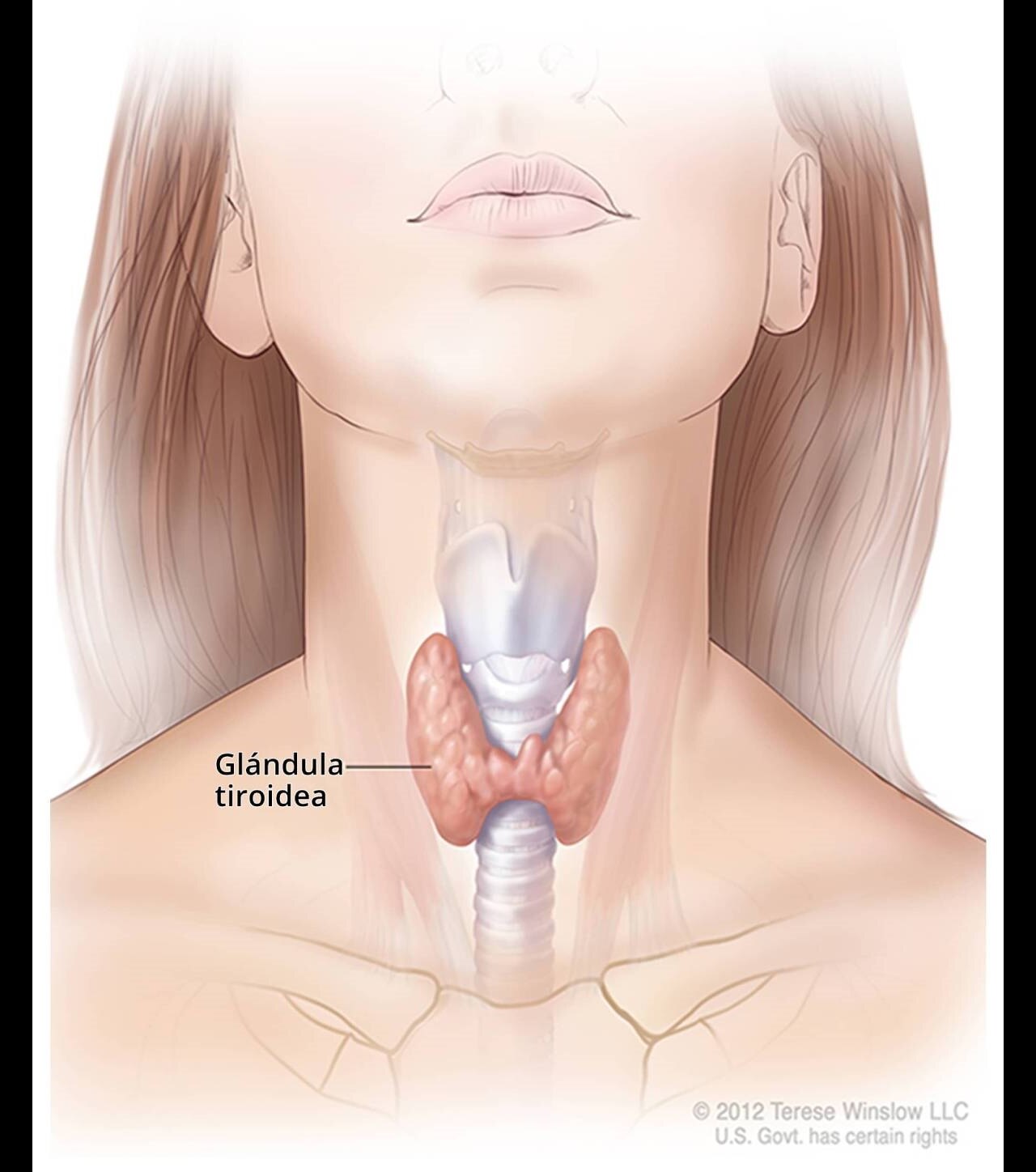 Ilustración de la tiroides y su ubicación en el cuello.