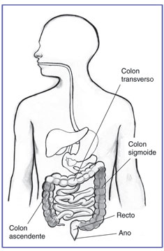 Dibujo del tracto digestivo en el que se señala el colon ascendente, colon transverso, colon sigmoide, recto y ano. El colon ascendente y el colon sigmoide están sombreados.