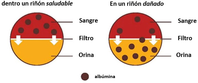 Diagrama que muestra un riñón sano con albúmina solo en la sangre y un riñón dañado que tiene albúmina tanto en la sangre como en la orina.