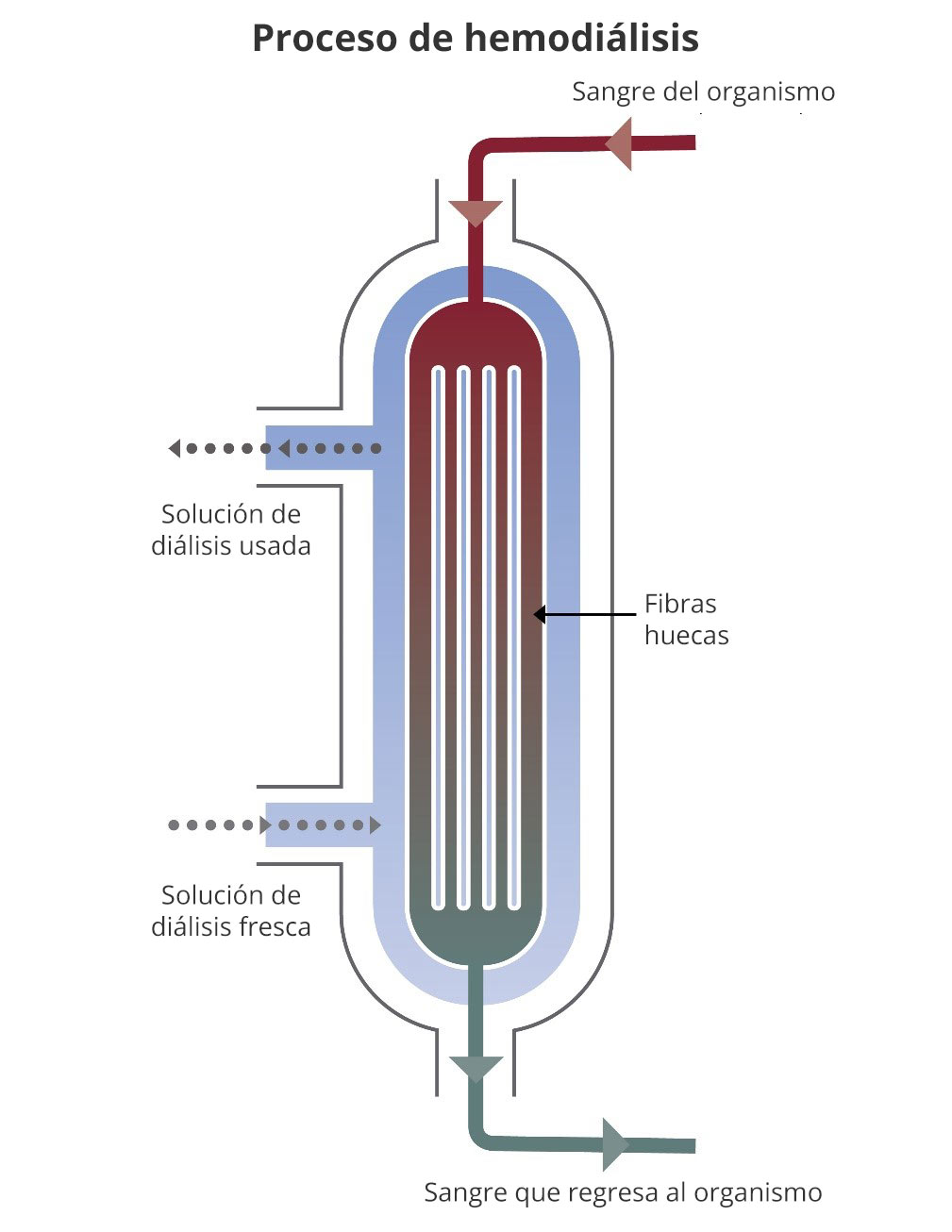 Diagrama del flujo sanguíneo desde la parte superior del dializador hasta la parte inferior. La solución de diálisis fluye en dirección opuesta, de abajo hacia arriba. La sección transversal muestra fibras huecas dentro del dializador, donde pasan las toxinas de la sangre a la solución.