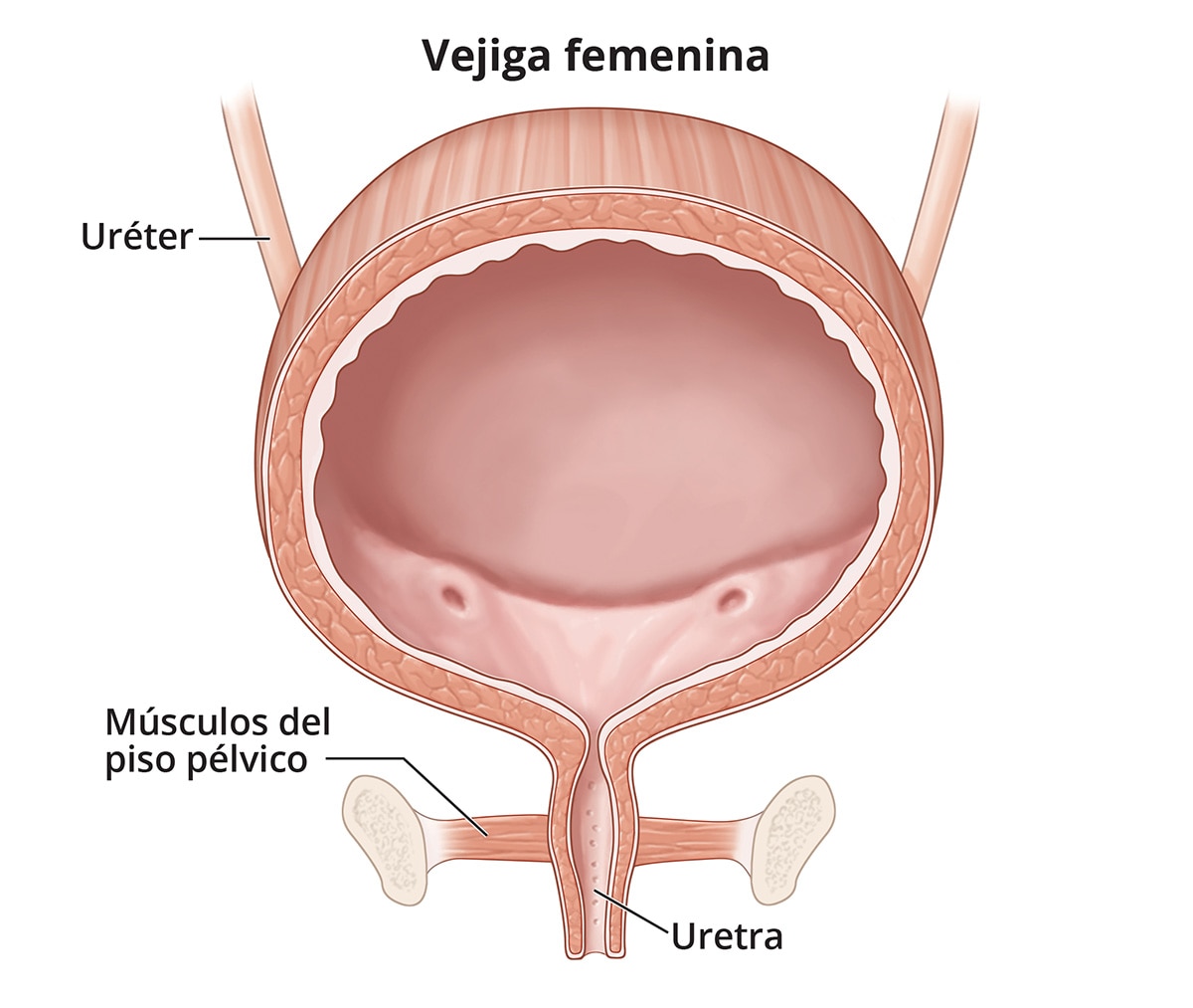 Incontinencia urinaria - Qué es, causas, tipos de incontinencia y