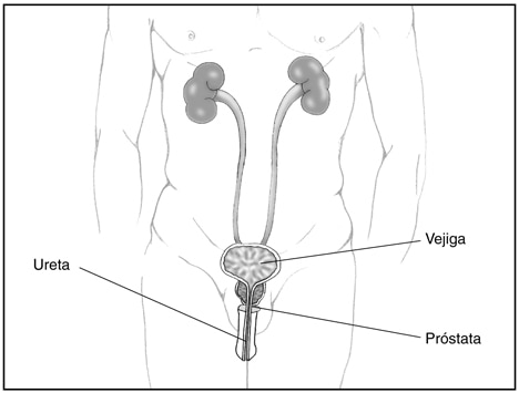 prostata psa alto causas Leeches prostatitis gyógyult