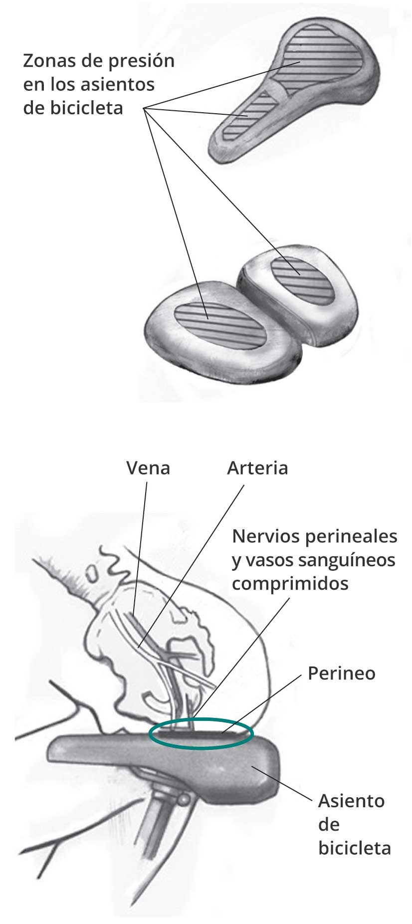 Las regiones de presión de los asientos de bicicletas con y sin nariz. Una segunda imagen muestra un corte transversal de una persona sentada en un asiento de bicicleta con nariz. Se muestra con un círculo la presión resultante en el perineo junto con los nervios y los vasos sanguíneos comprimidos.