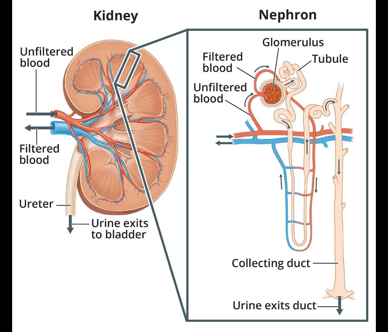 Alt-text: Two illustrations. A human kidney, with arrows showing where unfiltered blood enters the kidney and filtered blood leaves the kidney. Wastes and extra water leave the kidney through the ureter to the bladder as urine. An inset image shows a microscopic view of a nephron, one of the tiny units in the kidney that filters the blood. Arrows show the path unfiltered blood takes into the glomerulus, which filters it. Arrows also show how waste leaves the glomerulus via the tubule, which takes it to the collecting duct. The collecting duct collects the extra waste and water that leave the body as urine. Labels point to the unfiltered blood, filtered blood, glomerulus, tubule, and collecting duct