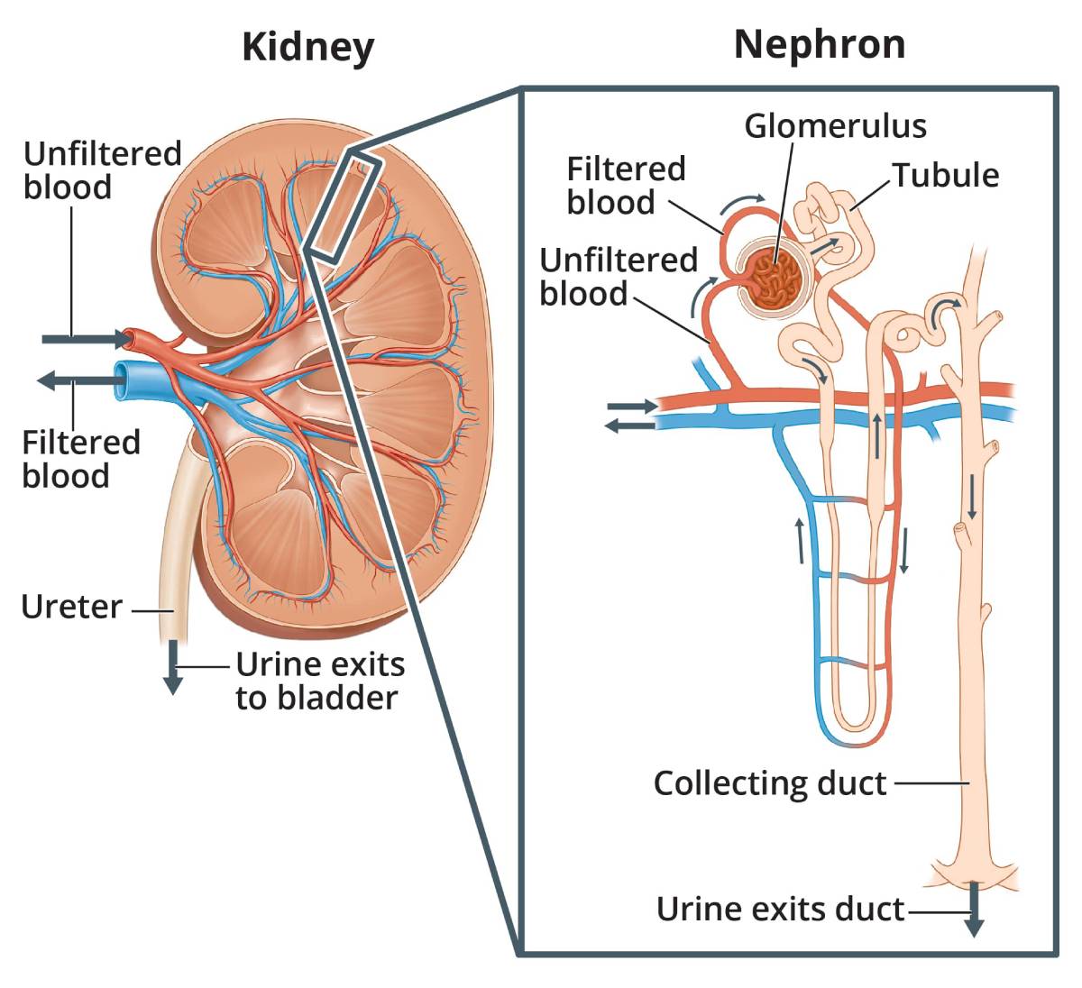 Nephrotic Syndrome in Children - NIDDK