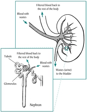 Pathophysiology Of Nephrotic Syndrome In Flow Chart