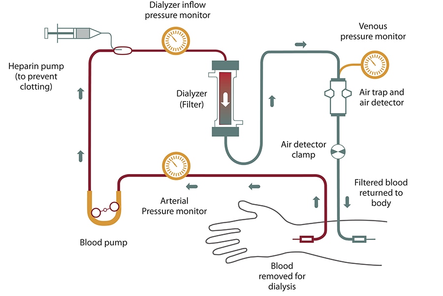 Dialysis Charting Examples