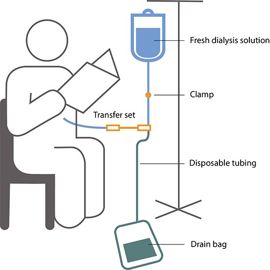 Peritoneal Dialysis NIDDK
