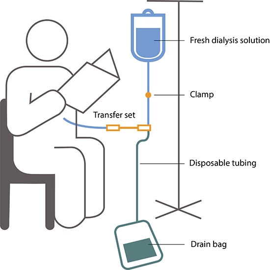 Dialysis Chart