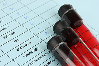 blood panel test cirrhosis lab tests iron testing metabolic diagnosis complete liver results thyroid deficiency anemia labs comp study comprehensive
