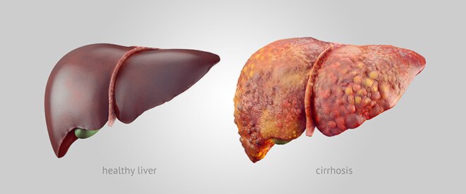 liver