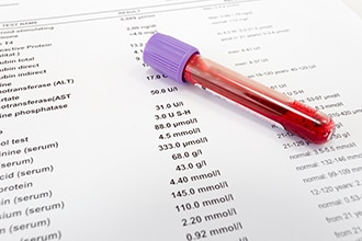 Sangre roja en un tubo de ensayo sobre una copia impresa en papel de los resultados de la prueba.