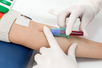 Health care professional drawing a blood sample from a patient’s arm.