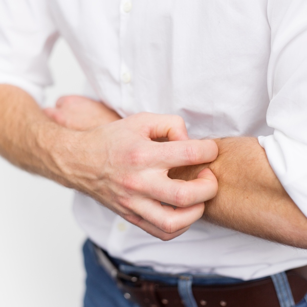 Man scratching itchy skin on his arm.