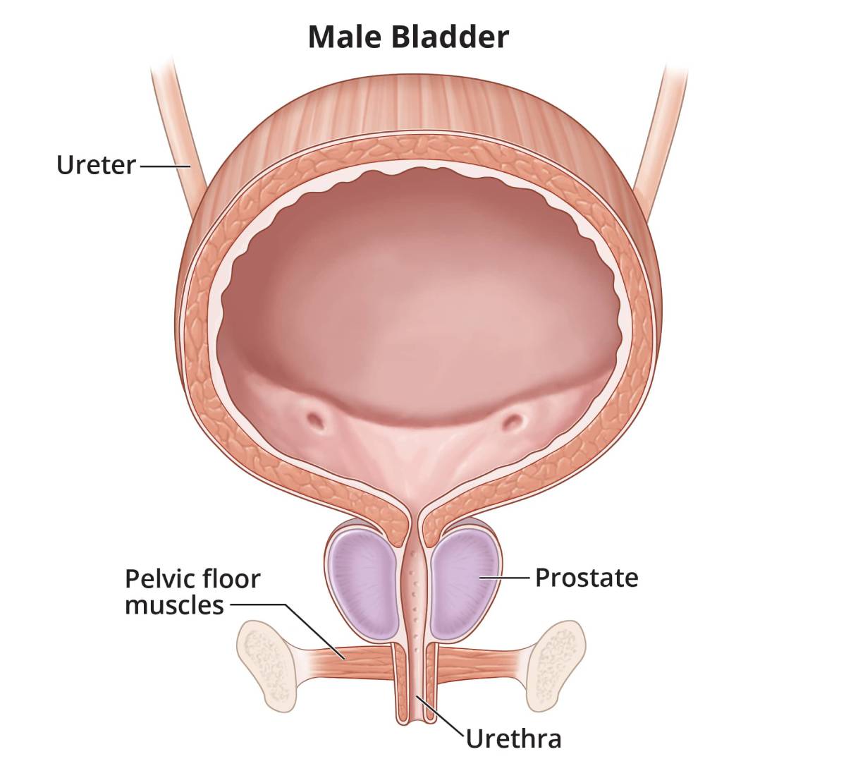Close-up illustration of a male urinary tract, including the bladder, ureters, pelvic floor muscles, and urethra, and showing the prostate.