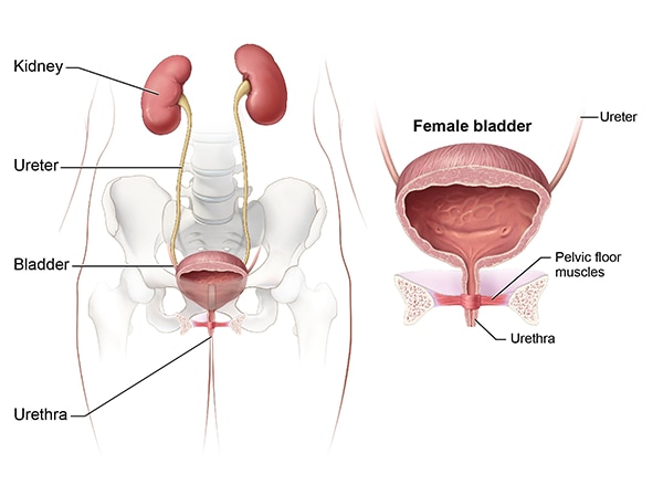 Urinary incontinence in women