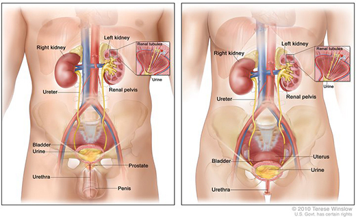 Hematuria Color Chart