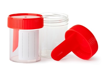 Foto de recipientes pequeños de plástico vacíos con tapas que se usan para recoger muestras de orina.