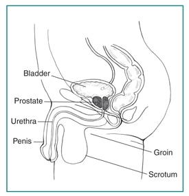 The Prostate And Bladder Problems in Hungarian | Continence Foundation of Australia