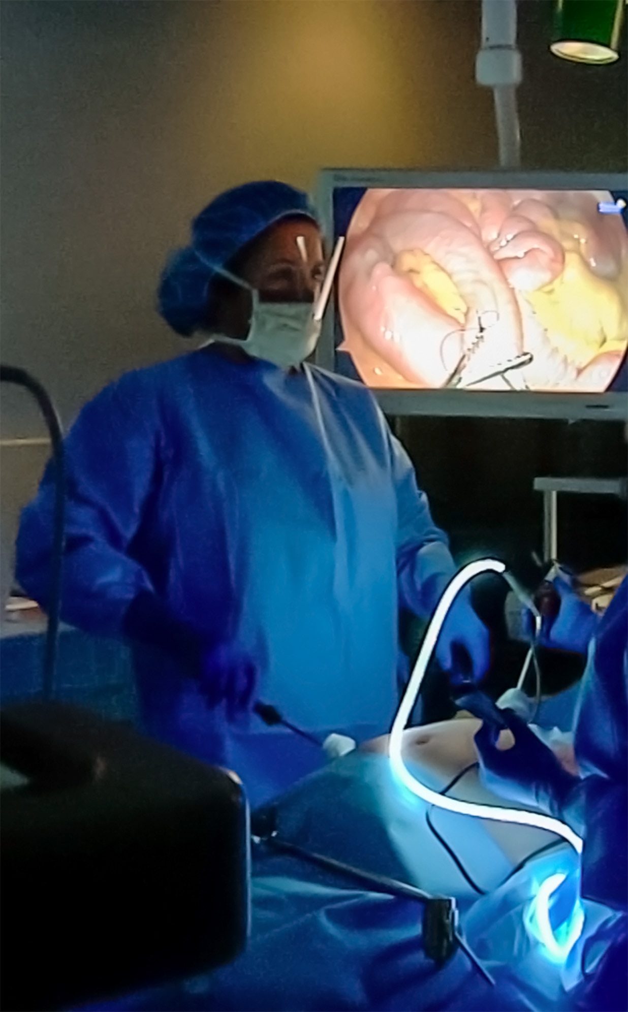 A surgeon performs an abdominal laparoscopic surgery
