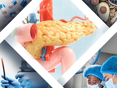 Web rotator for the meeting workshop titled "Interventions for Pancreatitis: New Approaches, Knowledge Gaps, and Research Opportunities"