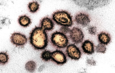 Transmission electron microscopy image showing SARS-CoV-2, the virus that causes COVID-19.