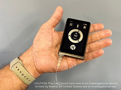 Hand holding the iLet bionic pancreas device.
