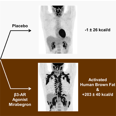 drug activates brown fat