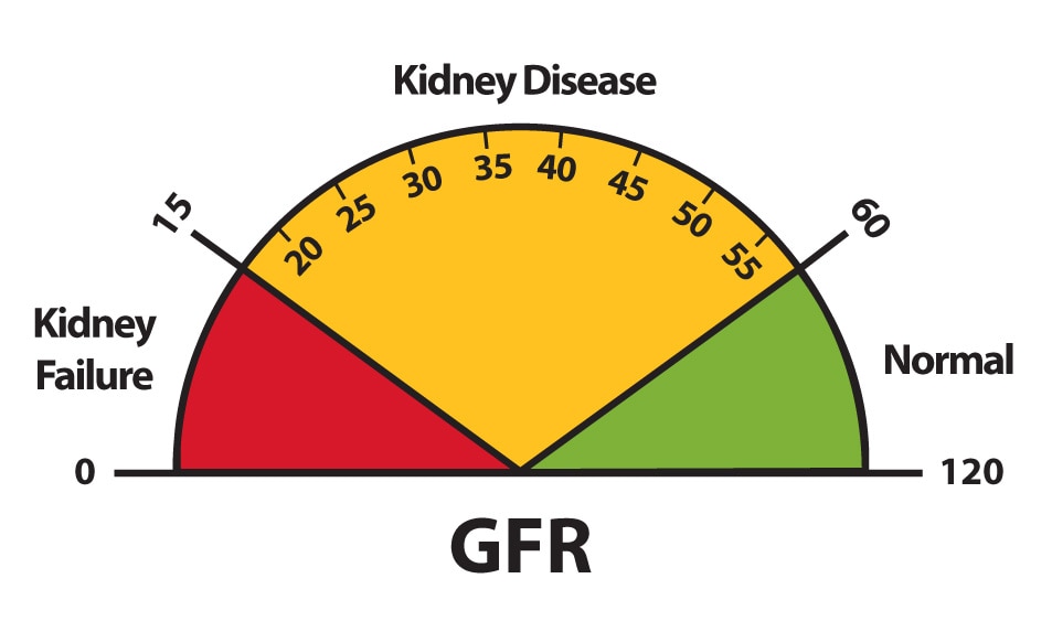 A graphic of a speedometer-like dial that depicts GFR results of 0 to 15 as kidney failure, 15 to 60 as kidney disease, and 60 to 120 as normal