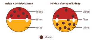 Explaining Your Kidney Test Results: A Tear-off Pad for Clinical Use