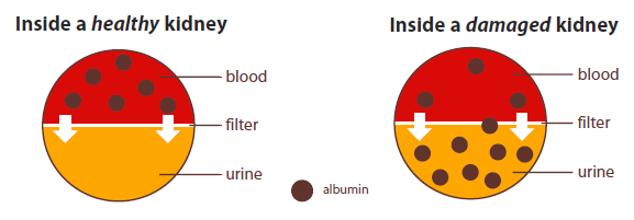Image of urine albumin test results