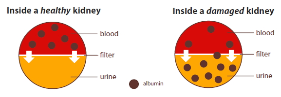 Kidney Gfr Chart