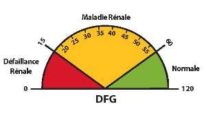 Une graphique que ilustre que un DFG de 60 ou plus est dans la plage normale, que un DFG inferieur à 60 peut signifier une maladie renale, et que un DFG de 15 ou moins peut signifier une defaillance rénale
