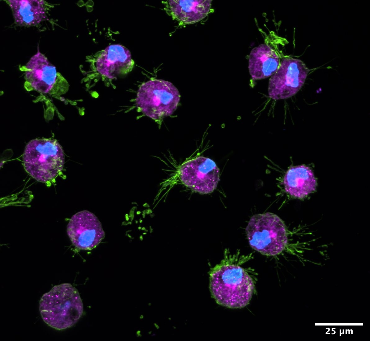 Slide of human iPSC-derived microglia stained for neutral lipids.
