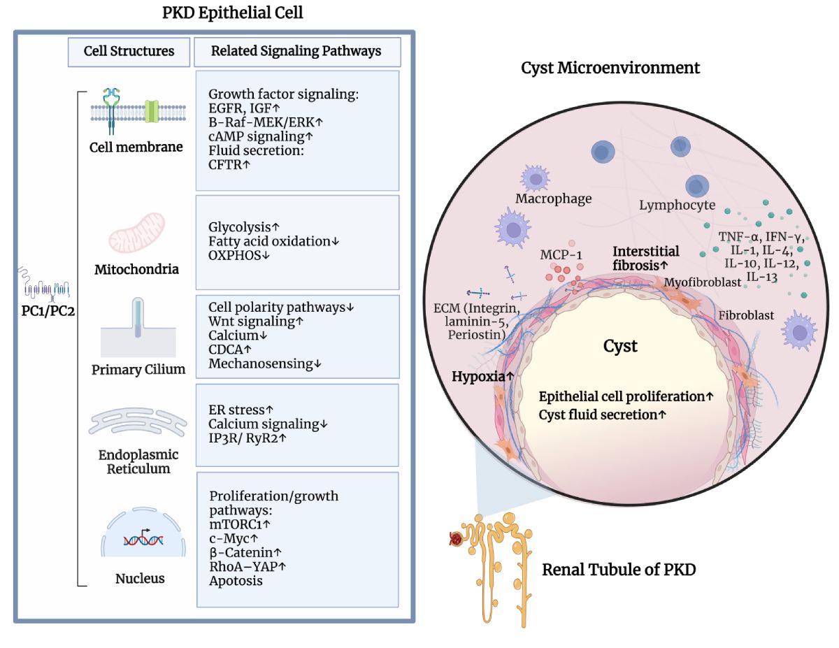 Overview of cystic pathways.