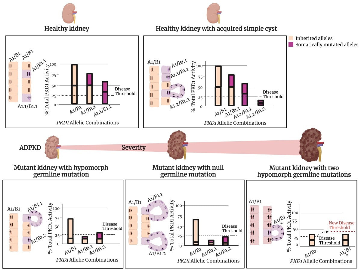 Threshold model of cyst formation