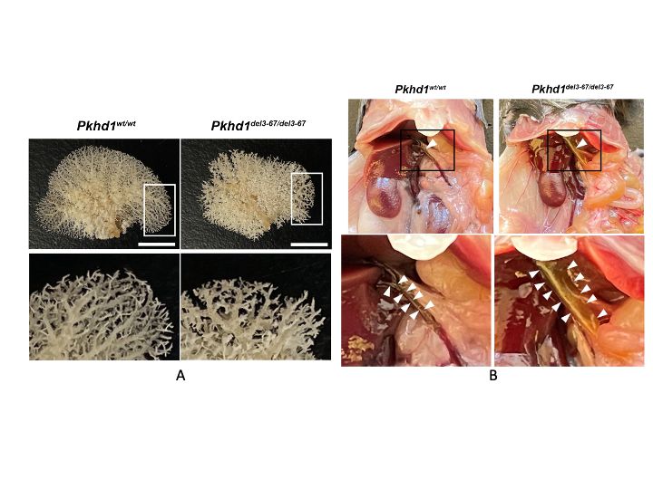 Pkhd1 mutant livers have an abnormal biliary system.