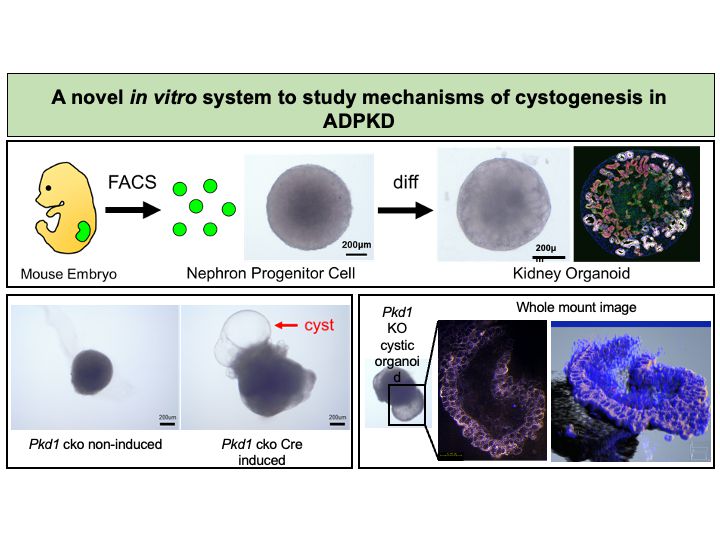 A novel in vitro system to study mechanisms of cystogenesis in ADPKD