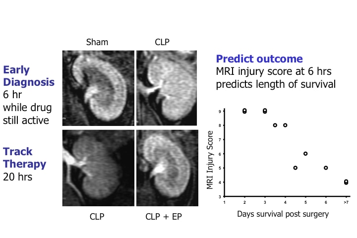 Photo of Dendrimer MRI as a biomarker in sepsis
