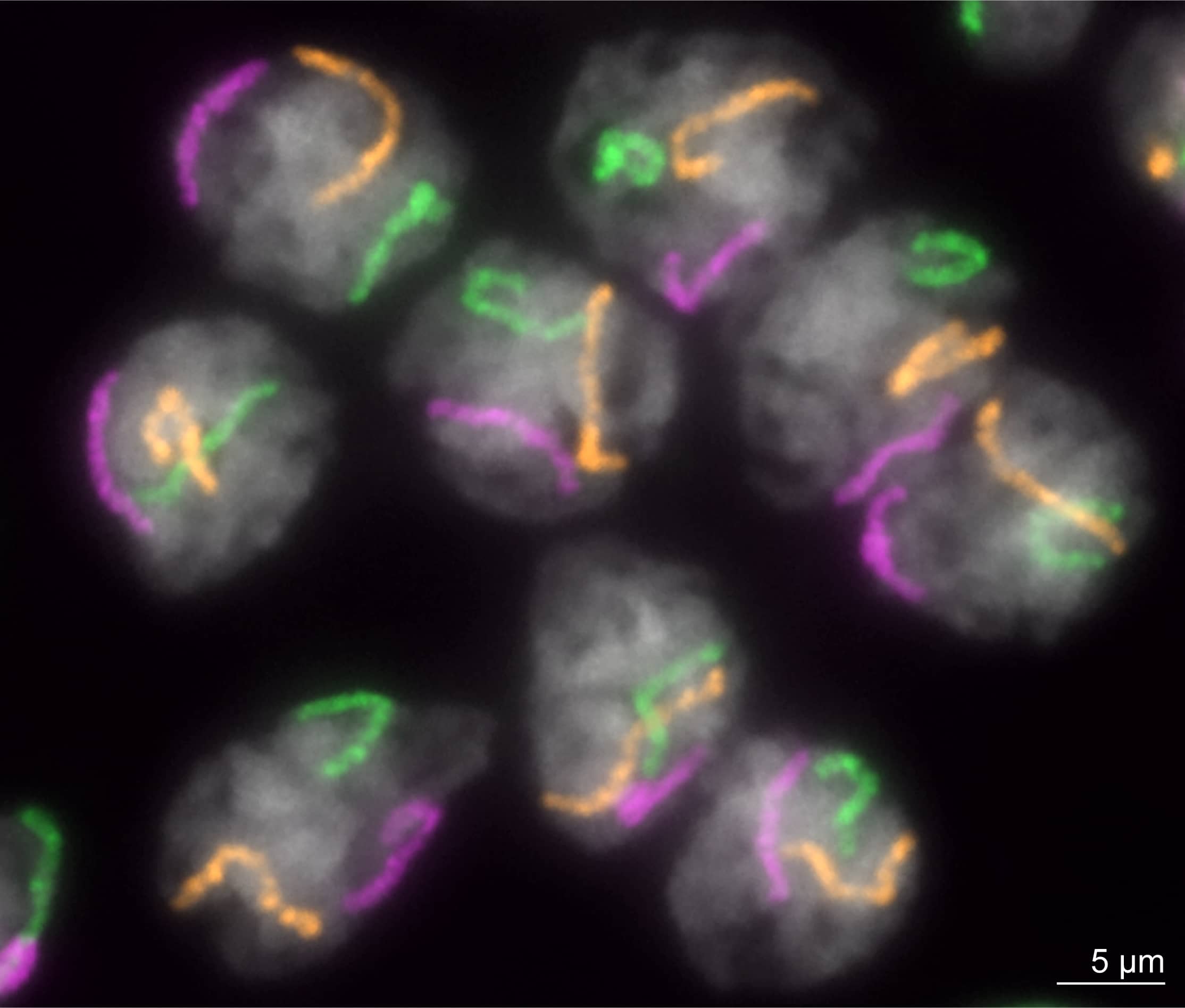 Sperm-destined cells in early meiosis from the developing testes of the domestic silkworm Bombyx mori.