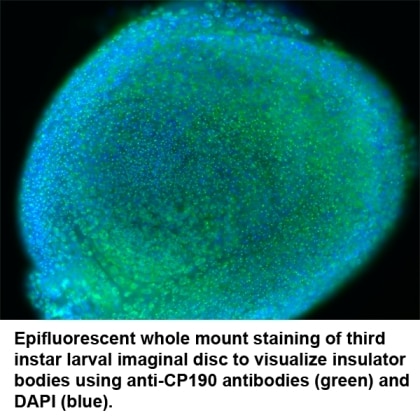 Photo showing polytene chromosomes of Drosophilia