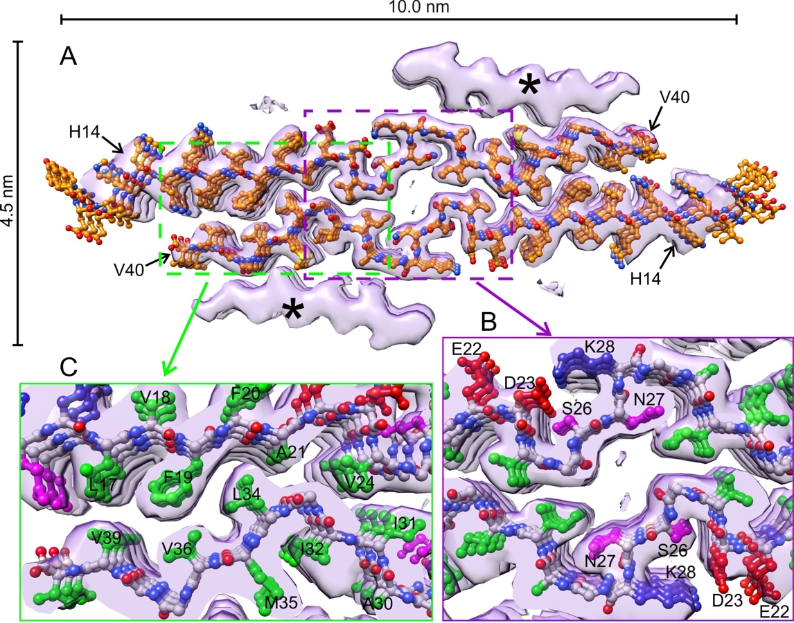 Molecular structure of brain-derived amyloid- fibrils from cryo-electron microscopy