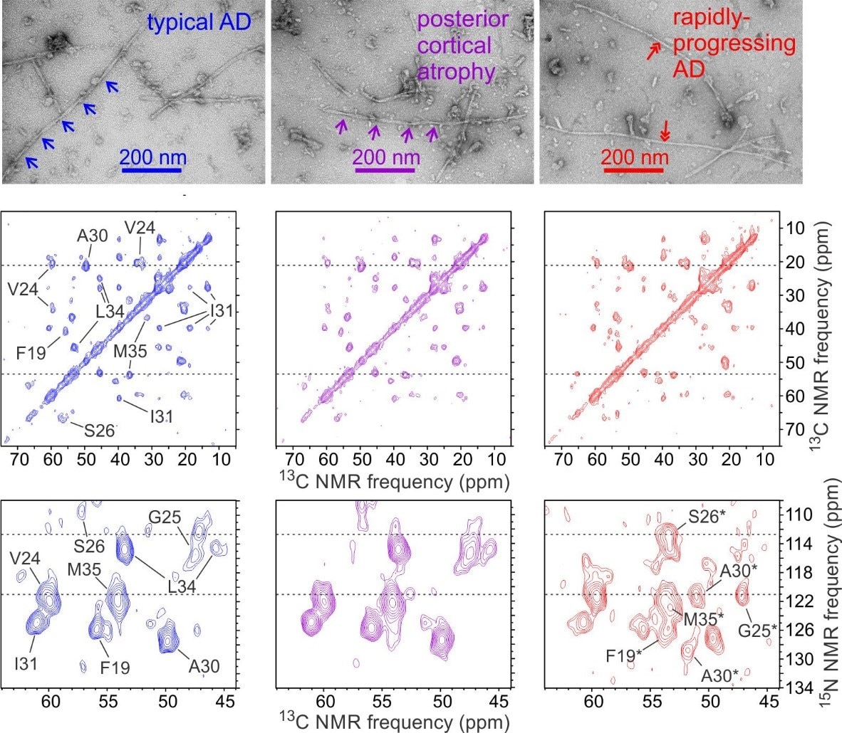 Electron microscope images and 2D NMR spectra of amyloid fibrils from Alzheimer’s brain tissue.