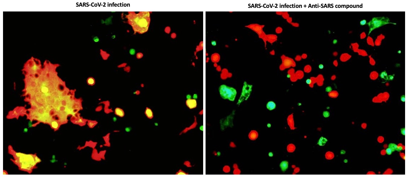 Antivirals that inhibit SARS-CoV-2 infection (COVID-19) by blocking how the virus enters the cells.